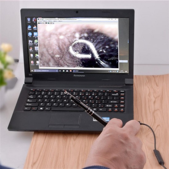 5.5mm Digital USB Borescope Inspection Visual Otoscope Camera for PC