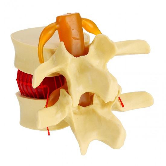 Anatomical Human Skeleton Spine Lumbar Vertebrae Degenerative Disc Medical Model