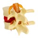 Anatomical Human Skeleton Spine Lumbar Vertebrae Degenerative Disc Medical Model Anatomical Human Skeleton Spine Lumbar Vertebrae Degenerative Disc Medical Model