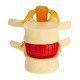 Anatomical Human Skeleton Spine Lumbar Vertebrae Degenerative Disc Medical Model Anatomical Human Skeleton Spine Lumbar Vertebrae Degenerative Disc Medical Model
