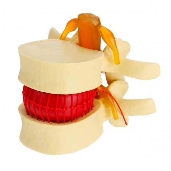 Anatomical Human Skeleton Spine Lumbar Vertebrae Degenerative Disc Medical Model Anatomical Human Skeleton Spine Lumbar Vertebrae Degenerative Disc Medical Model