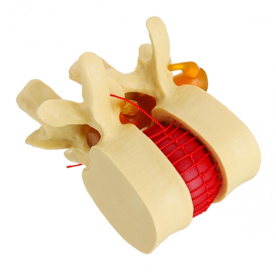 Anatomical Human Skeleton Spine Lumbar Vertebrae Degenerative Disc Medical Model Anatomical Human Skeleton Spine Lumbar Vertebrae Degenerative Disc Medical Model
