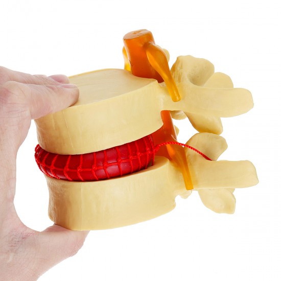 Anatomical Human Skeleton Spine Lumbar Vertebrae Degenerative Disc Medical Model