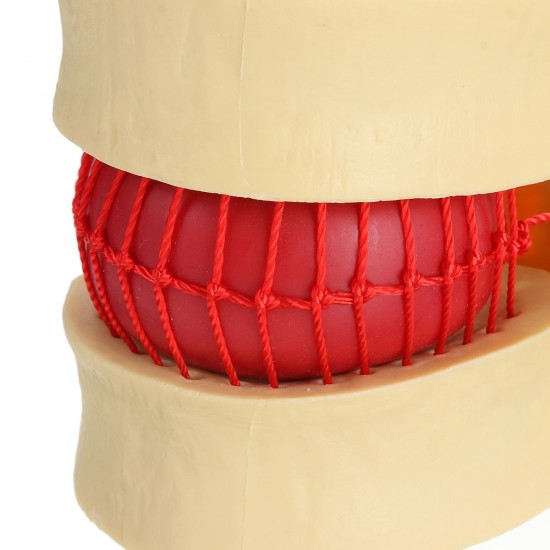 Anatomical Human Skeleton Spine Lumbar Vertebrae Degenerative Disc Medical Model Anatomical Human Skeleton Spine Lumbar Vertebrae Degenerative Disc Medical Model