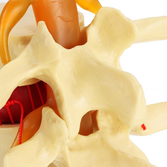 Anatomical Human Skeleton Spine Lumbar Vertebrae Degenerative Disc Medical Model