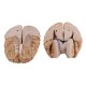 Life Size Human Brain Model w/ Arteries Medical Anatomical Cerebral Model Base Science Teaching 8 Parts