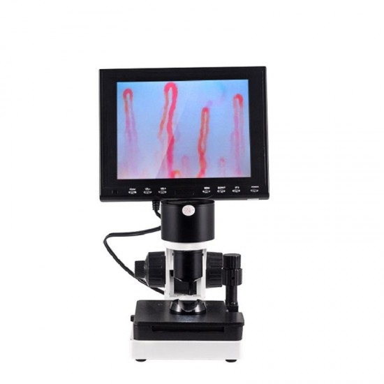 380X HD 7 Inch Portable Nailfold Capillary Microcirculation Microscope 380X HD 7 Inch Portable Nailfold Capillary Microcirculation Microscope