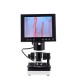 380X HD 7 Inch Portable Nailfold Capillary Microcirculation Microscope 380X HD 7 Inch Portable Nailfold Capillary Microcirculation Microscope