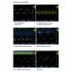 TO1104 100MHz Digital Tablet Oscilloscope 8inch TFT LCD Touch Screen 4CH 28Mpts 1GSa/s Oscilloscope Automotive Diagnostic with Battery