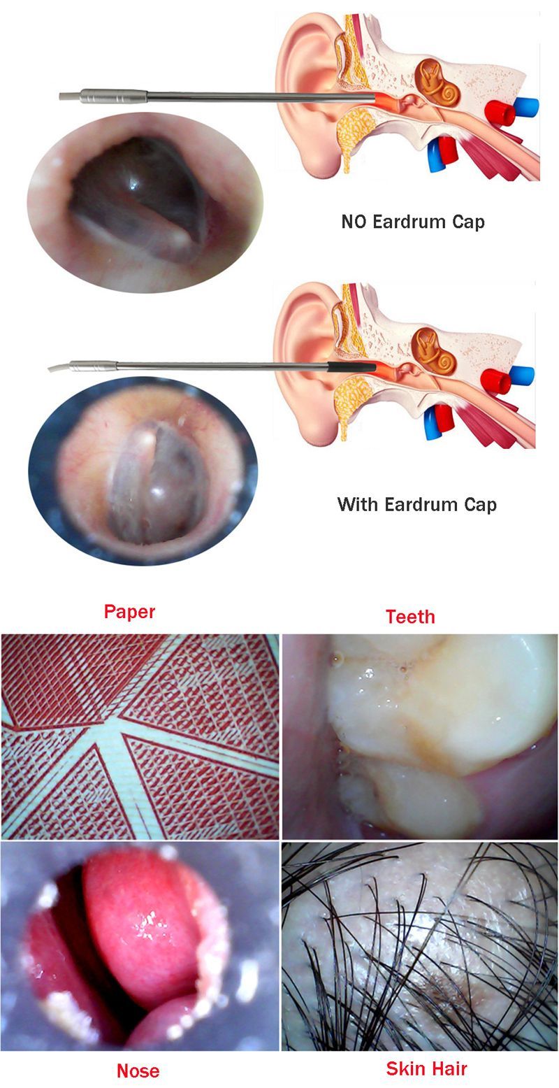 49mm-Lens-USB-Ear-Nose-Borescope-Inspection-Otoscope-Camera-for-OTG-Android-Phone-PC-1251320