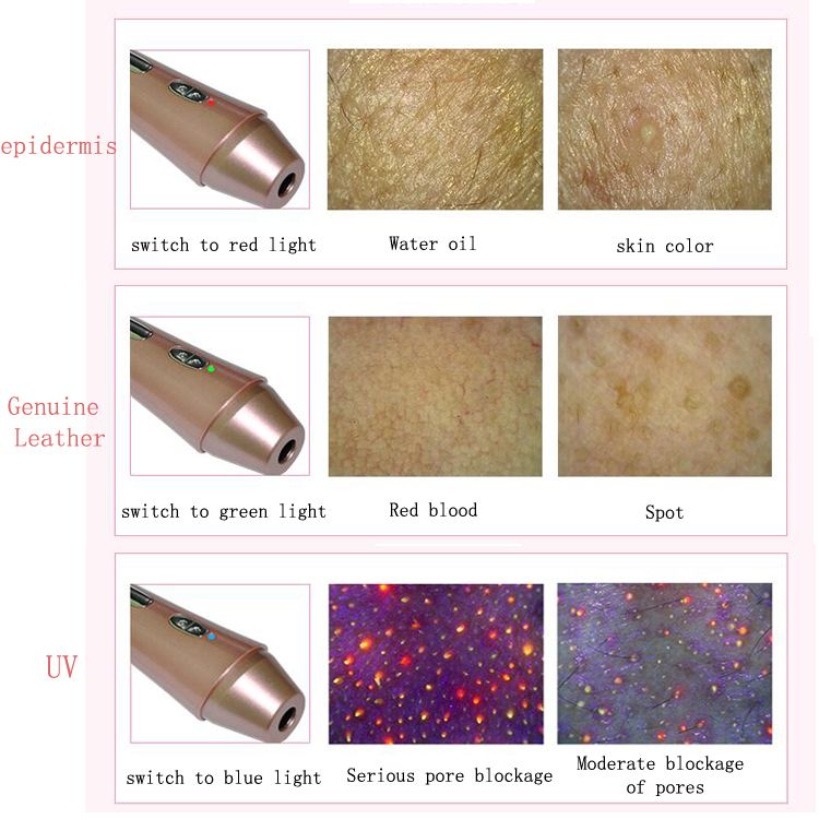 HT-DS02-Three-Color-Light-Mirror-Automatic-Skin-Analyzer-8-Test-Report-of-Epidermal-Leather-UV-Light-1529496