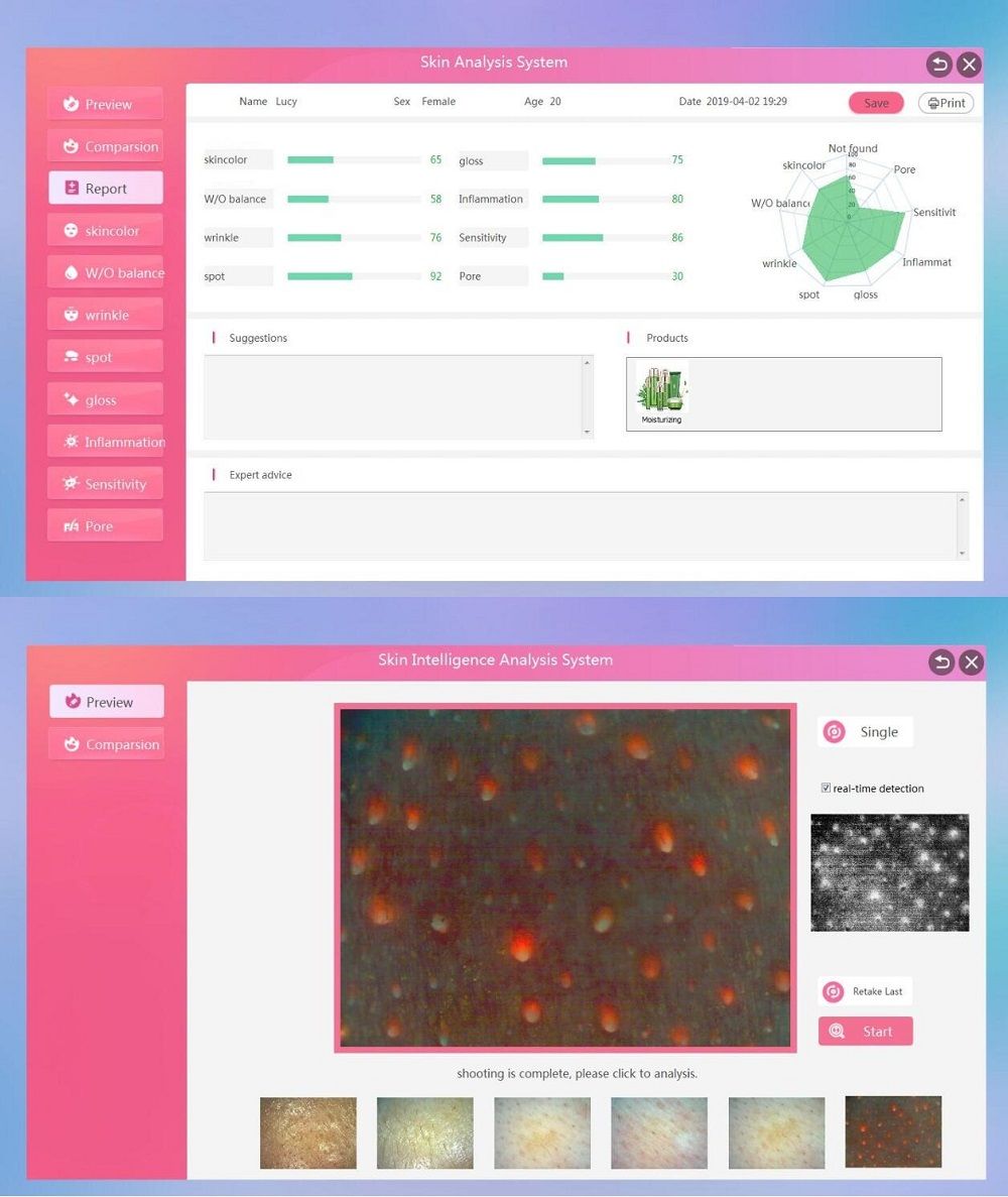 HT-DS02-Three-Color-Light-Mirror-Automatic-Skin-Analyzer-8-Test-Report-of-Epidermal-Leather-UV-Light-1529496