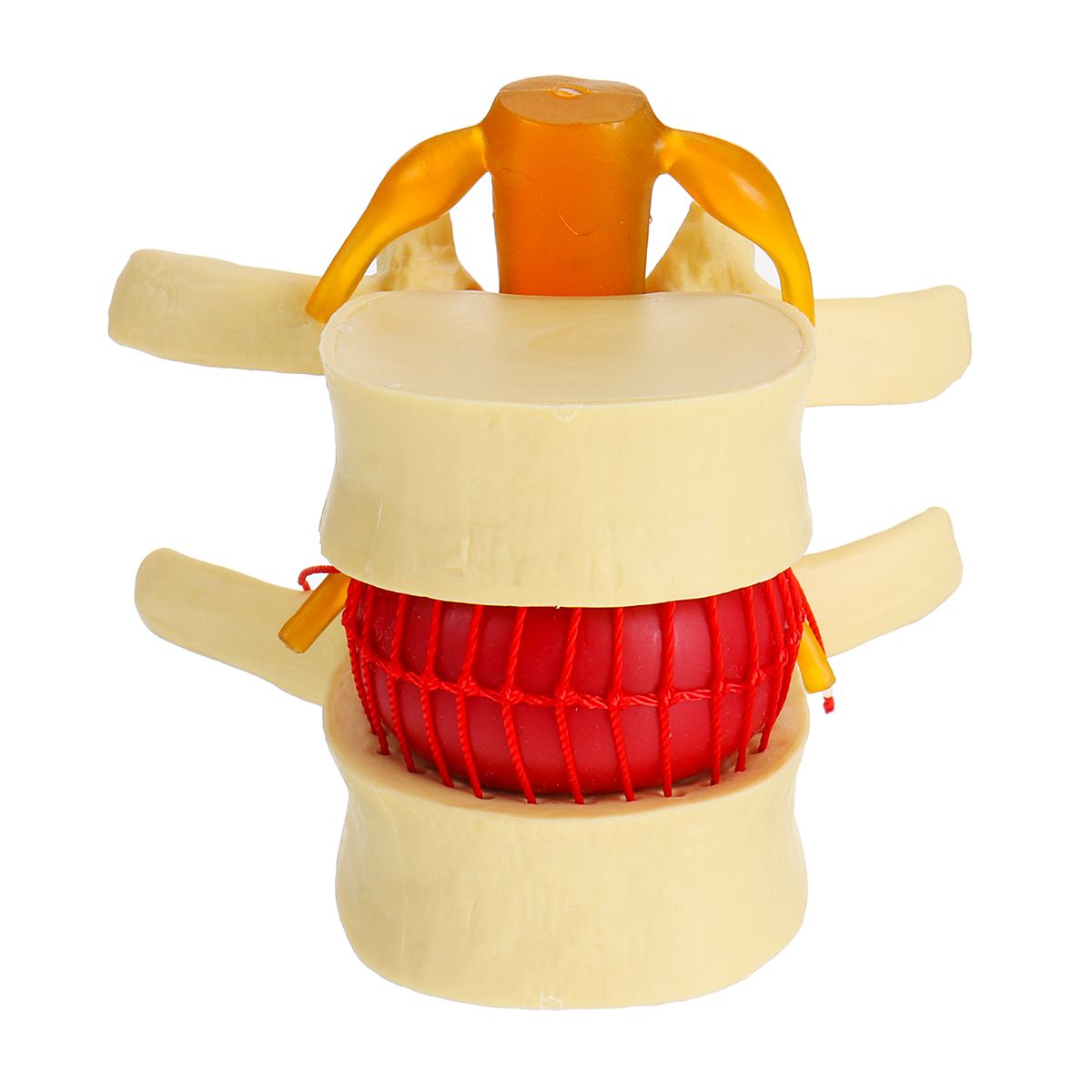 Anatomical-Human-Skeleton-Spine-Lumbar-Vertebrae-Degenerative-Disc-Medical-Model-1532845