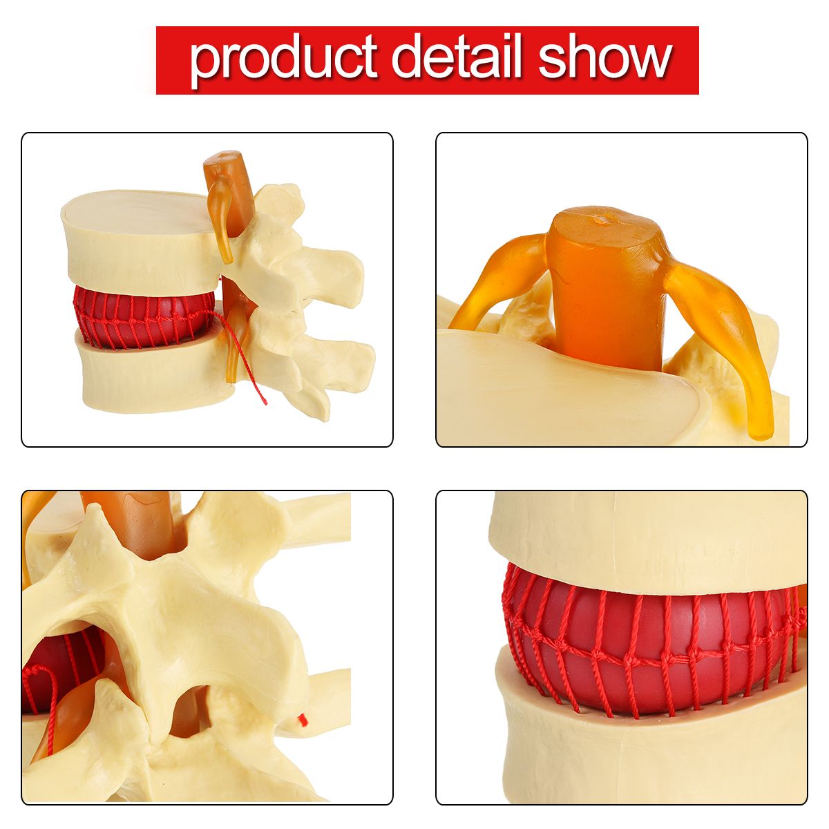 Anatomical-Human-Skeleton-Spine-Lumbar-Vertebrae-Degenerative-Disc-Medical-Model-1532845