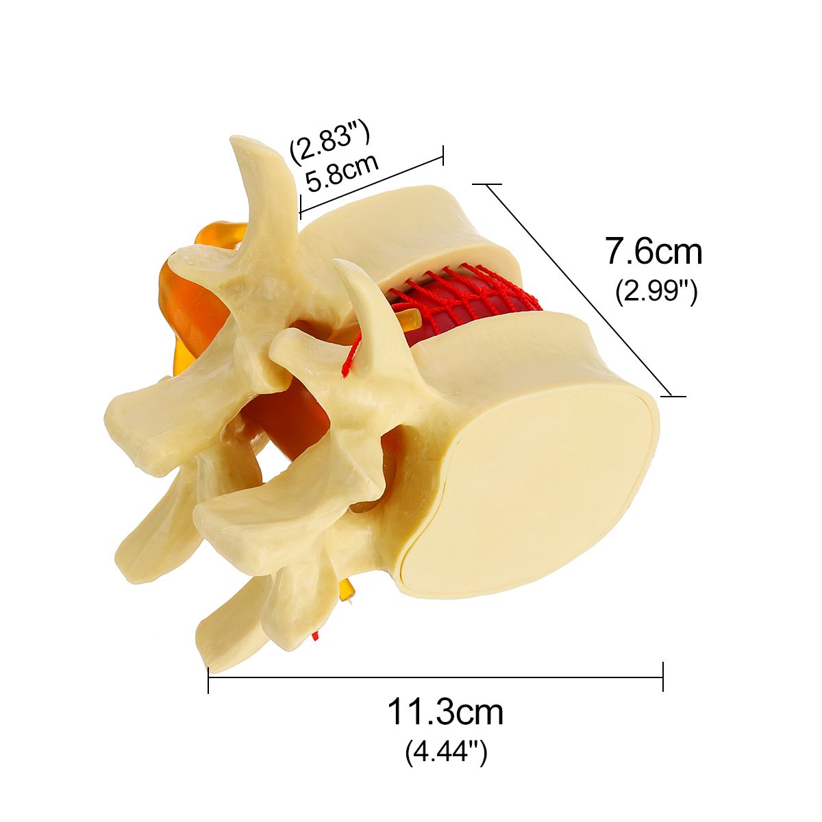 Anatomical-Human-Skeleton-Spine-Lumbar-Vertebrae-Degenerative-Disc-Medical-Model-1532845