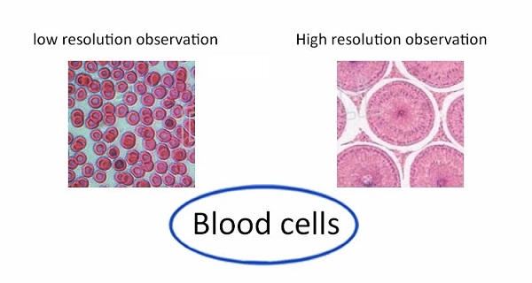 7-Inch-Screen-Sperm-Biological-Microcirculation-Capillary-MicroscopeDarkfield-Live-Blood-Analysis-Mi-1594475