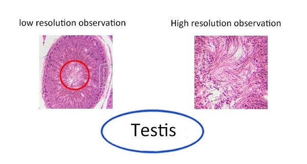 7-Inch-Screen-Sperm-Biological-Microcirculation-Capillary-MicroscopeDarkfield-Live-Blood-Analysis-Mi-1594475