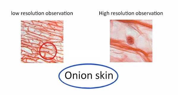 7-Inch-Screen-Sperm-Biological-Microcirculation-Capillary-MicroscopeDarkfield-Live-Blood-Analysis-Mi-1594475