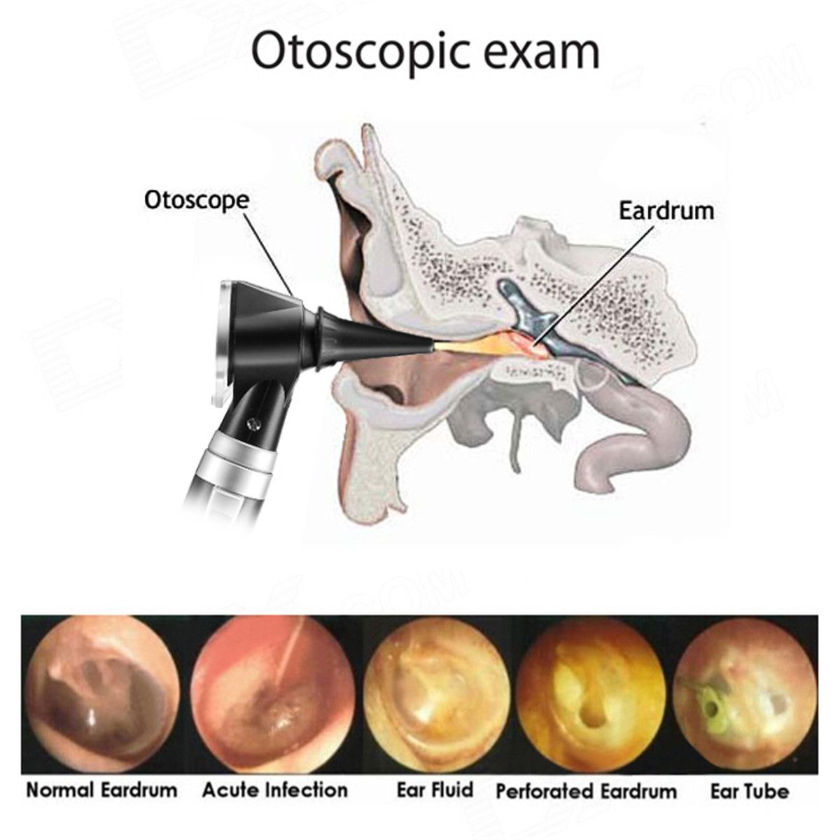 Professional-Diagnostic-Otoscope-Fiber-Optic-Wide-Field-Ear-Diagnostic-1250264