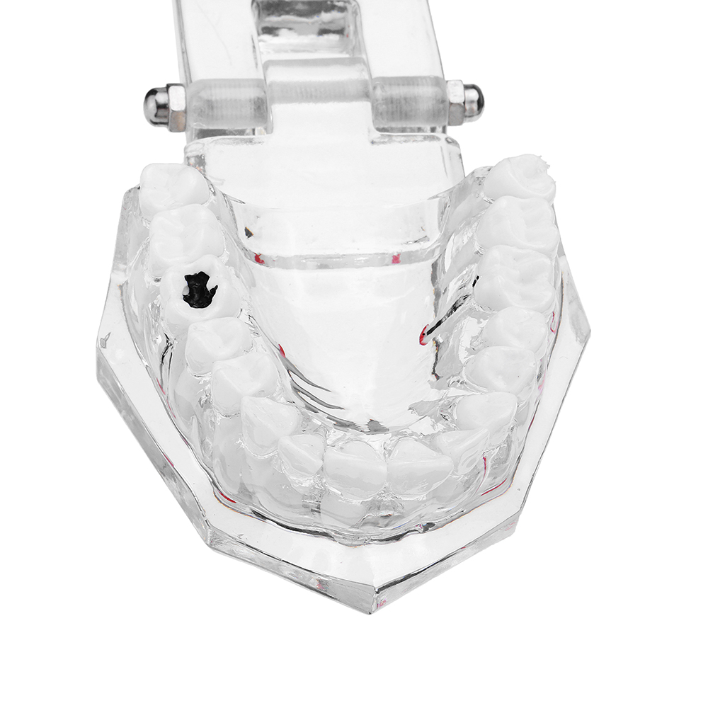 Clear-Dental-Teeth-Study-Teaching-Model-Crystal-Typodont-Model-Removable-Teeth-Model-Medical-Model-1478077